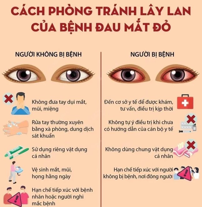 CÁC BIỆN PHÁP PHÒNG TRÁNH VÀ LÂY LAN BỆNH ĐAU MẮT ĐỎ